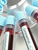 Ukraine reports 810 new coronavirus cases in the past 24 hours