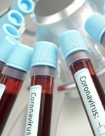 Ukraine confirms 113 coronavirus cases