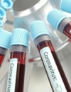 Ukraine reports 5,804 new coronavirus cases