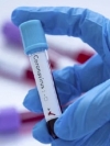 Ukraine reports 4,633 new coronavirus cases
